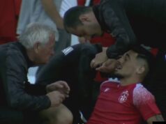 Shënoi supergol ndaj Kukësit, Tedi Cara goditet me shishe nga tifozët verilindorë dhe gjakoset (Video)