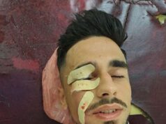 Supergol dhe 7 të qepura, rrëfehet kavajasi Tedi Cara: Shishja ishte plot me akull, rezerva për policinë!