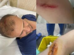 Gazetari Shkëlzen Henkoja dhunohet në hyrje të banesës, autorët i dëmtojnë edhe makinën